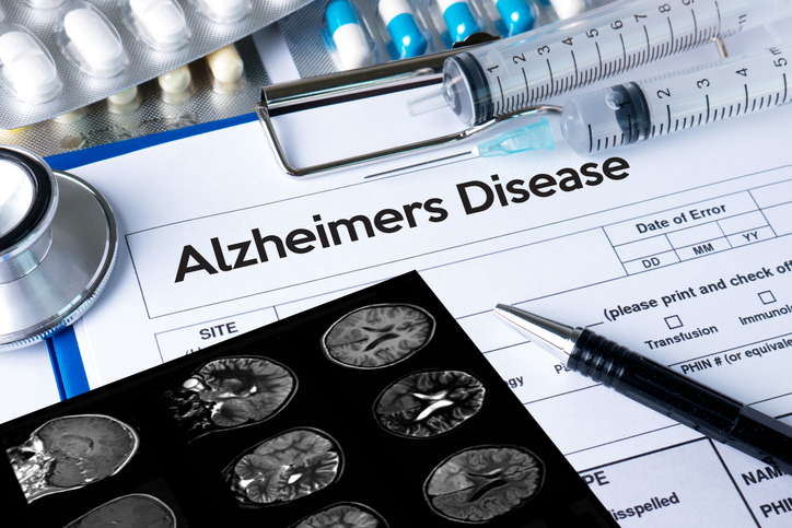 アルツハイマー認知症に効果的な薬が！2025年問題を解決できるか？
